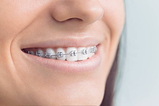 Best Teeth Whitening  in Lansing, KS